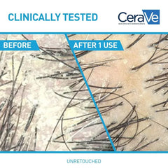 CeraVe Anti-Dandruff 2-in-1 Shampoo & Conditioner - 12 fl oz: For Curly, Dry Hair, Daily Use, Paraben-Free, Alcohol-Free