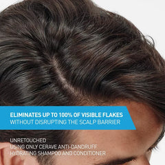 CeraVe Anti-Dandruff Scalp Care Shampoo - 12 fl oz: No Fragrance Added, Hypoallergenic, Paraben-Free, Contains Hyaluronic Acid