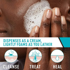 CeraVe Acne Foaming Cream Face Cleanser, Acne Treatment Face Wash - Fragrance-Free - 5oz: Paraben-Free, Noncomedogenic, Contains Hyaluronic Acid