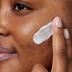 CeraVe Acne Control Foaming Face Cleanser 10% BPO - 5 fl oz: Paraben-Free, Noncomedogenic, With Niacinamide
